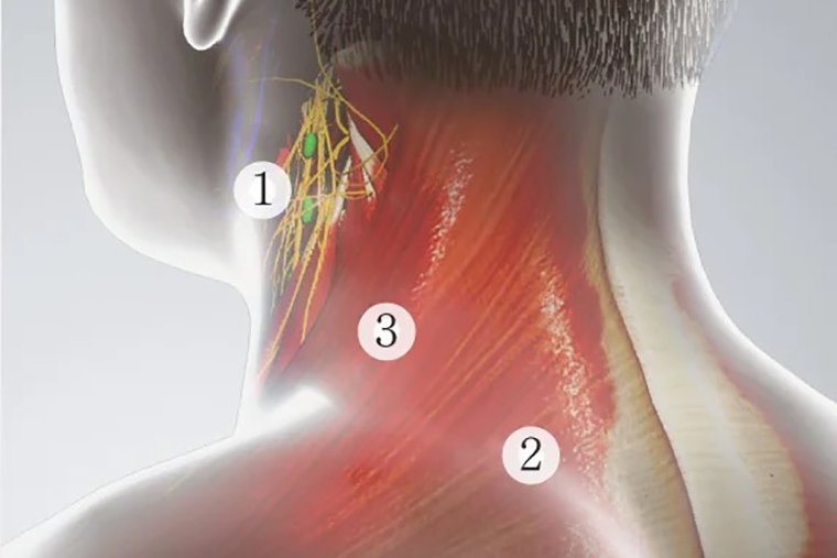 Massage cổ Mytrex Dr. Heat Neck